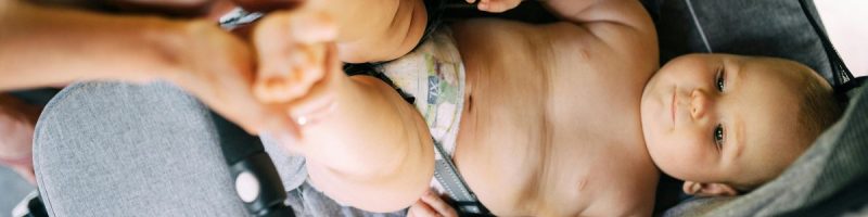 A Complete Parent’s Guide to Recognizing Foot Deformities in Babies